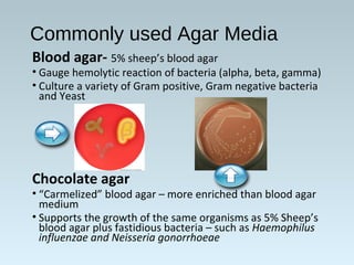 Commonly used Agar Media
Blood agar- 5% sheep’s blood agar
• Gauge hemolytic reaction of bacteria (alpha, beta, gamma)
• C...