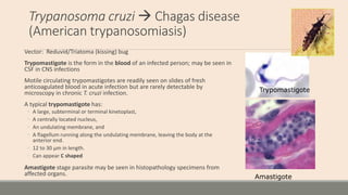 Trypanosoma cruzi  Chagas disease
(American trypanosomiasis)
Vector: Reduvid/Triatoma (kissing) bug
Trypomastigote is the...