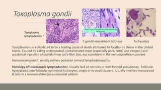 Toxoplasma gondii
T. gondii encystment in tissue Tachyzoites
Toxoplasmosis is considered to be a leading cause of death at...