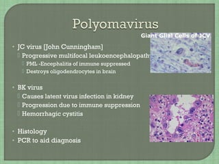 • JC virus [John Cunningham]
 Progressive multifocal leukoencephalopathy -
 PML -Encephalitis of immune suppressed
 Destroys oligodendrocytes in brain
• BK virus
 Causes latent virus infection in kidney
 Progression due to immune suppression
 Hemorrhagic cystitis
• Histology
• PCR to aid diagnosis
Giant Glial Cells of JCV
 