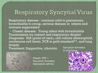  Respiratory disease - common cold to pneumonia,
bronchiolitis to croup, serious disease in infants and
immune suppressed
• Classic disease: Young infant with bronchiolitis
 Transmission by contact and respiratory droplet
 Diagnosis: EIA (point of care), cell culture (heteroploid,
continuous cell lines), PCR is gold standard**, and lung
biopsy
 Treatment: Supportive, ribavirin
Classic CPE =
Syncytium formation
heteroploid cell line
Syncytium formation
In lung tissue
 
