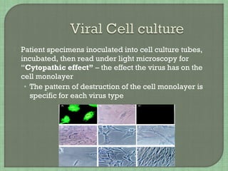  Patient specimens inoculated into cell culture tubes,
incubated, then read under light microscopy for
“Cytopathic effect” – the effect the virus has on the
cell monolayer
• The pattern of destruction of the cell monolayer is
specific for each virus type
 