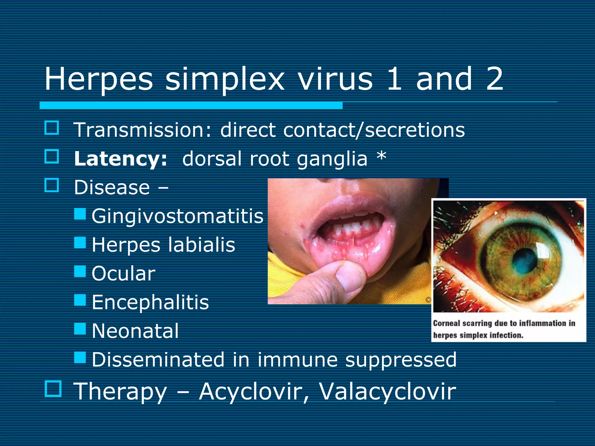 Herpes simplex virus 1 and 2
 Transmission: direct contact/secretions
 Latency: dorsal root ganglia *
 Disease –
 Gingivostomatitis
 Herpes labialis
 Ocular
 Encephalitis
 Neonatal
 Disseminated in immune suppressed

 Therapy – Acyclovir, Valacyclovir

 