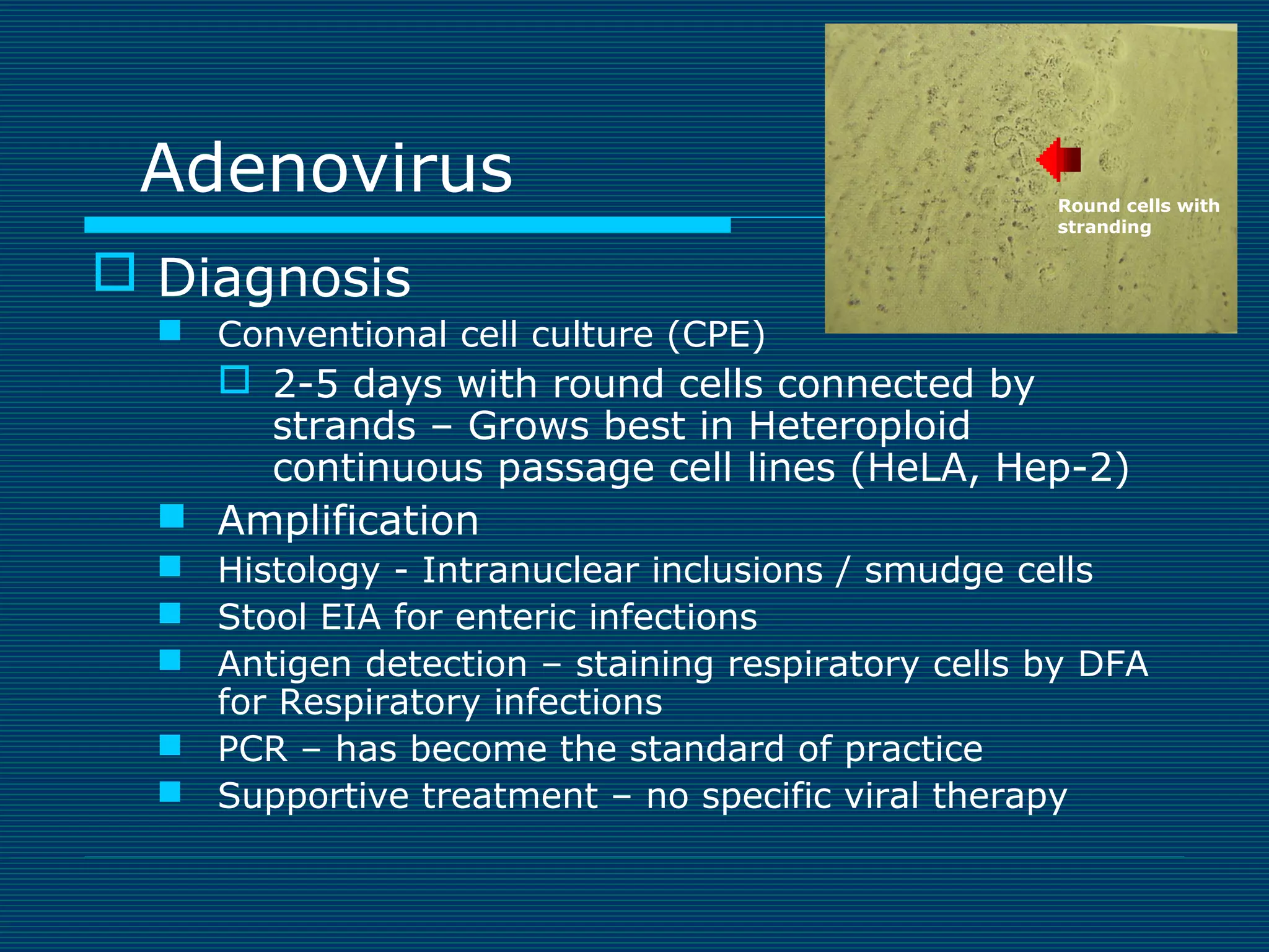 Adenovirus

Round cells with
stranding

 Diagnosis
 Conventional cell culture (CPE)

 2-5 days with round cells connected by
strands – Grows best in Heteroploid
continuous passage cell lines (HeLA, Hep-2)
 Amplification
 Histology - Intranuclear inclusions / smudge cells
 Stool EIA for enteric infections
 Antigen detection – staining respiratory cells by DFA
for Respiratory infections
 PCR – has become the standard of practice
 Supportive treatment – no specific viral therapy

 