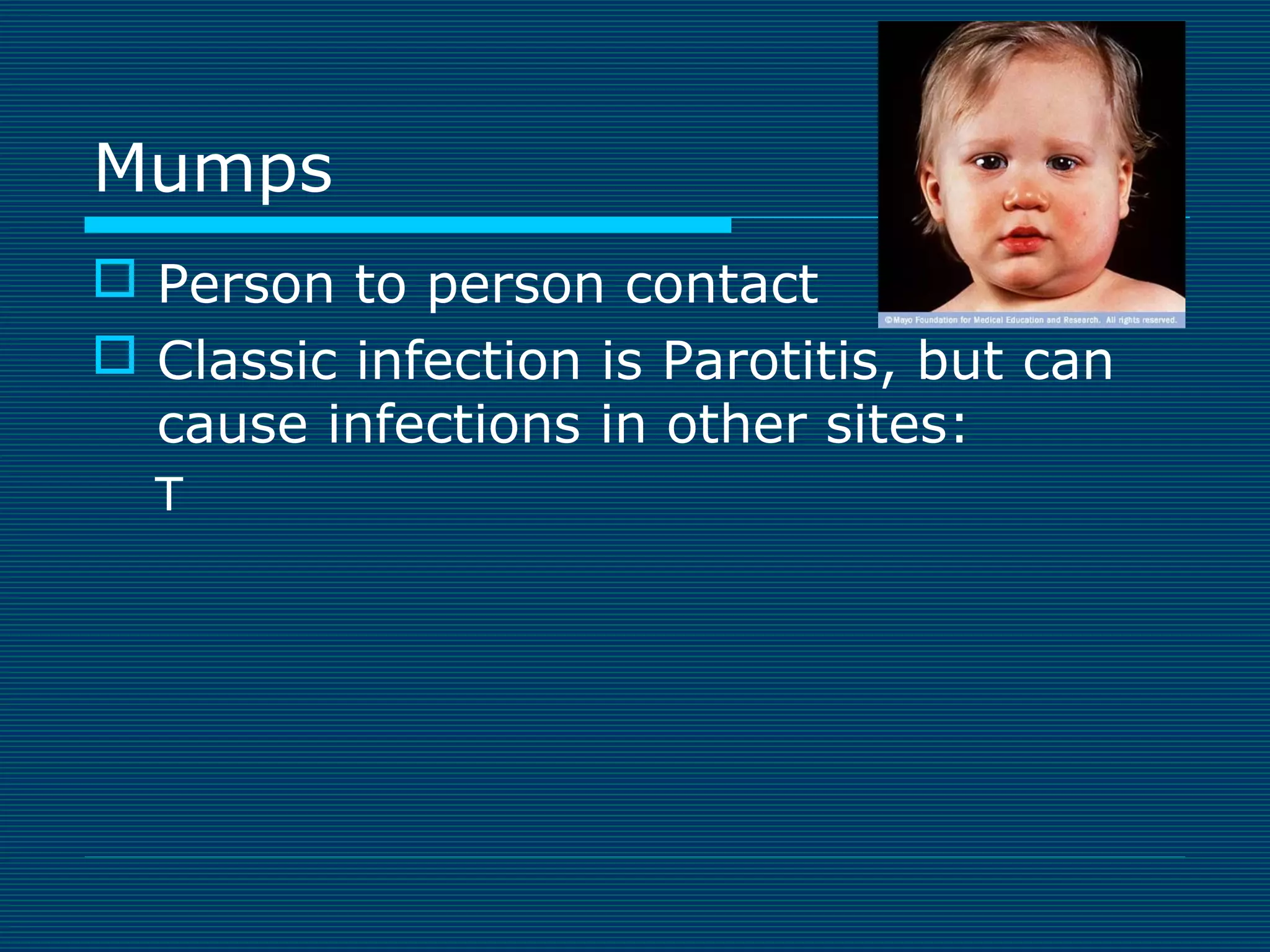 Mumps
 Person to person contact
 Classic infection is Parotitis, but can
cause infections in other sites:
T

 