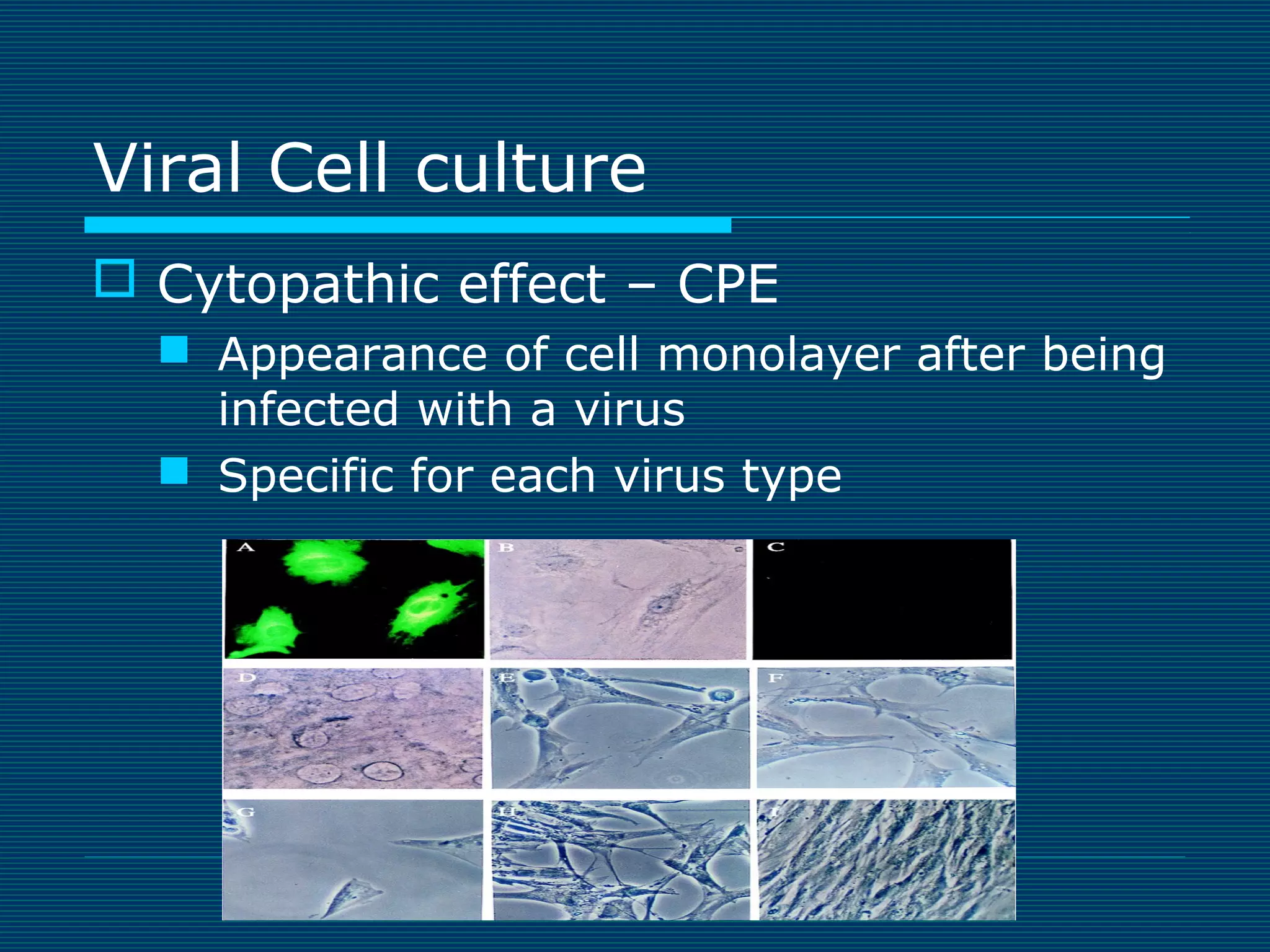 Viral Cell culture
 Cytopathic effect – CPE
 Appearance of cell monolayer after being
infected with a virus
 Specific for each virus type

 
