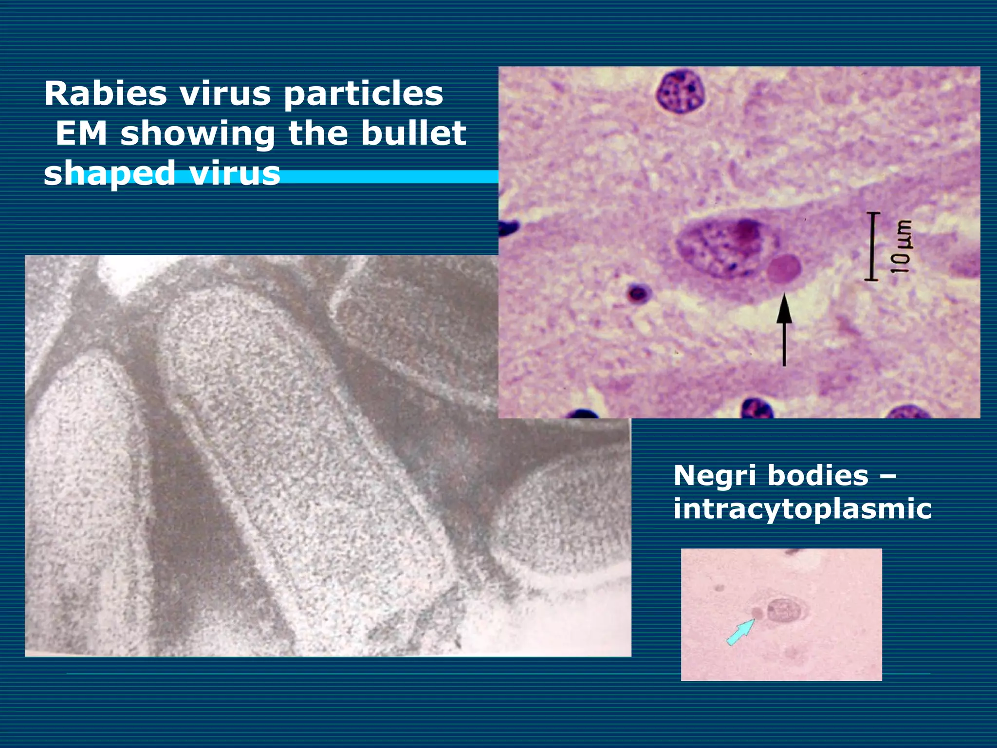 Rabies virus particles
EM showing the bullet
shaped virus

Negri bodies –
intracytoplasmic

 