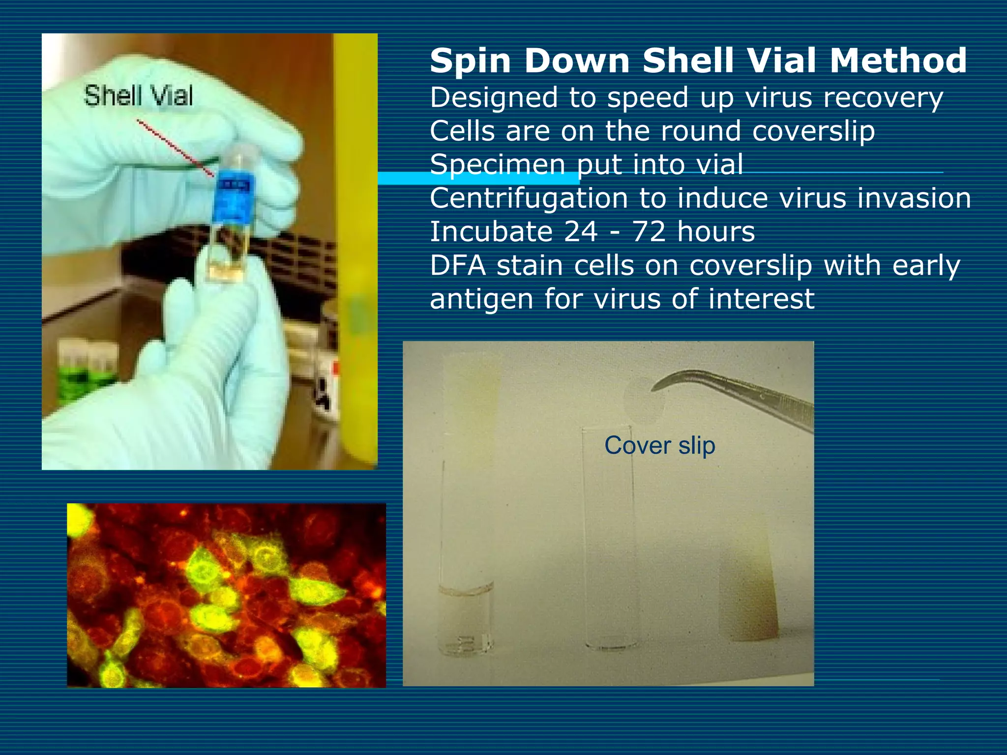 Spin Down Shell Vial Method

Designed to speed up virus recovery
Cells are on the round coverslip
Specimen put into vial
Centrifugation to induce virus invasion
Incubate 24 - 72 hours
DFA stain cells on coverslip with early
antigen for virus of interest

Cover slip

 