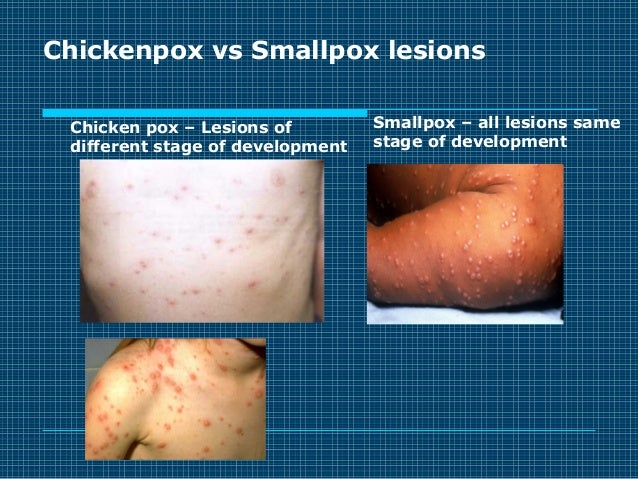 Virology Review