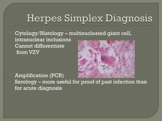  Cytology/Histology – multinucleated giant cell,
intranuclear inclusions
 Cannot differentiate
from VZV
 Amplification (PCR)
 Serology – more useful for proof of past infection than
for acute diagnosis
 