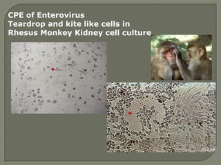 CPE of Enterovirus
Teardrop and kite like cells in
Rhesus Monkey Kidney cell culture
 