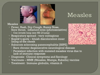  Measles
• Fever, Rash, Dry Cough, Runny Nose,
Sore throat, inflamed eyes (photosensitive)
 Can invade lung (see HE of Lung)
• Respiratory spread - very contagious
• Koplik’s spots – bluish discoloration inner
lining of the cheek
• Subacute sclerosing panencephalitis [SSPE]
 Rare chronic degenerative neurological disease
 Persistent infection with mutated measles virus due to
lack of immune response
• Diagnosis: Clinical symptoms and Serology
• Vaccinate – MMR (Measles, Mumps, Rubella) vaccine
• Treatment: Immune globulin, vitamin A
Measlessyncytium
 
