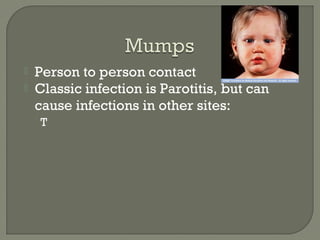  Person to person contact
 Classic infection is Parotitis, but can
cause infections in other sites:
T
 