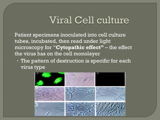  Patient specimens inoculated into cell culture
tubes, incubated, then read under light
microscopy for “Cytopathic effect” – the effect
the virus has on the cell monolayer
• The pattern of destruction is specific for each
virus type
 