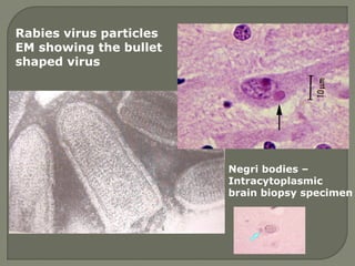 Rabies virus particles
EM showing the bullet
shaped virus
Negri bodies –
Intracytoplasmic
brain biopsy specimen
 
