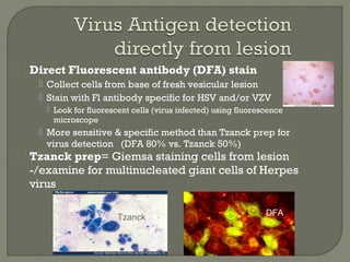  Direct Fluorescent antibody (DFA) stain
 Collect cells from base of fresh vesicular lesion
 Stain with Fl antibody spe...