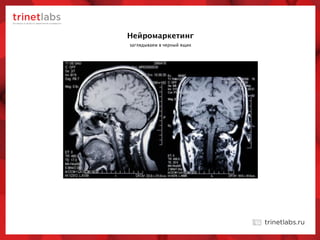 заглядываем в черный ящик
Нейромаркетинг
 