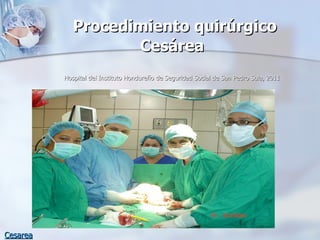   Procedimiento quirúrgico Cesárea Hospital del Instituto Hondureño de Seguridad Social de San Pedro Sula, 2011 Cesarea 