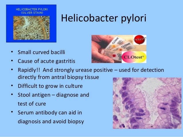 blood h pylori test or stool Bacteriology blood h pylori test or stool Bacteriology