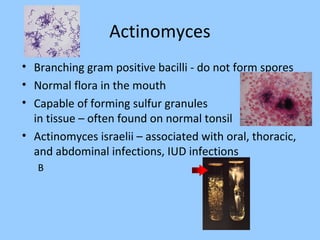 Actinomyces
• Branching gram positive bacilli - do not form spores
• Normal flora in the mouth
• Capable of forming sulfur granules
in tissue – often found on normal tonsil
• Actinomyces israelii – associated with oral, thoracic,
and abdominal infections, IUD infections
B
 