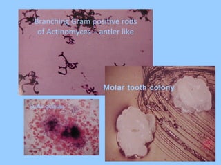 Branching Gram positive rods
of Actinomyces – antler like
Molar tooth colony
Sulfur granule
 