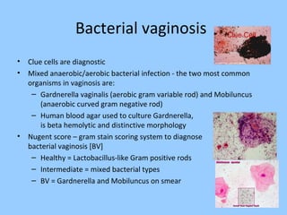 Bacterial vaginosis
• Clue cells are diagnostic
• Mixed anaerobic/aerobic bacterial infection - the two most common
organisms in vaginosis are:
– Gardnerella vaginalis (aerobic gram variable rod) and Mobiluncus
(anaerobic curved gram negative rod)
– Human blood agar used to culture Gardnerella, it
is beta hemolytic and distinctive morphology
• Nugent score – gram stain scoring system to diagnose
bacterial vaginosis [BV]
– Healthy = Lactobacillus-like Gram positive rods
– Intermediate = mixed bacterial types
– BV = Gardnerella and Mobiluncus on smear
Clue Cell
 