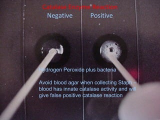 Catalase Enzyme Reaction
Negative Positive
Hydrogen Peroxide plus bacteria
Avoid blood agar when collecting Staph –
blood has innate catalase activity and will
give false positive catalase reaction
 