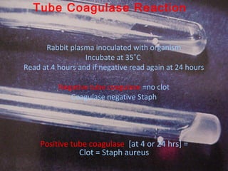Rabbit plasma inoculated with organism
Incubate at 35˚C
Read at 4 hours and if negative read again at 24 hours
Negative tube coagulase =no clot
Coagulase negative Staph
Positive tube coagulase [at 4 or 24 hrs] =
Clot = Staph aureus
Tube Coagulase Reaction
 