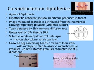 Corynebacterium diphtheriae
• Agent of Diphtheria
• Diphtheritic adherent pseudo membrane produced in throat
• Phage mediated exotoxin is distributed from the membrane
causing respiratory paralysis (virulence factor)
• Toxin detected by Elek immuno-diffusion test
• Grows well on 5% Sheep’s BAP
• Selective medium Cysteine Tellurite agar
– Produces black colonies with brown halos
• Grow on egg containing Loeffler medium then stain
with methylene blue to observe metachromatic
granules - colorful storage granules characteristic of C.
diphtheria
Elek plate
Tellurite agar
Metachromatic granules
 