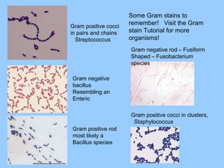 Gram positive cocci
in pairs and chains
Streptococcus
Gram negative
bacillus
Resembling an
Enteric
Gram positive rod
most likely a
Bacillus species
Gram positive cocci in clusters,
Staphylococcus
Gram negative rod – Fusiform
Shaped – Fusobacterium
species
Some Gram stains to
remember! Visit the Gram
stain Tutorial for more
organisms!
 