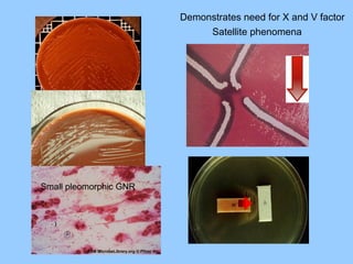 Satellite phenomena
Demonstrates need for X and V factor
Small pleomorphic GNR
 