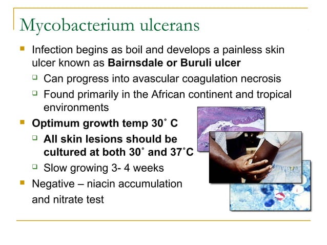 Mycobacteriology 2016 | PPT