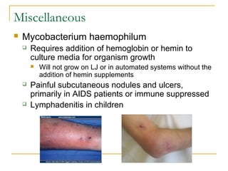 Miscellaneous
 Mycobacterium haemophilum
 Requires addition of hemoglobin or hemin to
culture media for organism growth
...