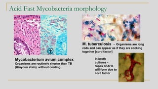 Acid Fast Mycobacteria morphology
Mycobacterium avium complex
Organisms are routinely shorter than TB
(Kinyoun stain) without cording
M. tuberculosis - Organisms are long
rods and can appear as if they are sticking
together [cord factor]
In broth
cultures -
ropes of AFB
will form due to
cord factor
 