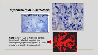 Mycobacterium tuberculosis
Cord factor – Due to high lipid content
in cell wall, rods stick together and
develop long ropes when grown in broth
media – unique to M. tuberculosis
Long AFB / stick together
 