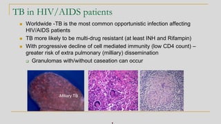 TB in HIV/AIDS patients
◼ Worldwide -TB is the most common opportunistic infection affecting
HIV/AIDS patients
◼ TB more likely to be multi-drug resistant (at least INH and Rifampin)
◼ With progressive decline of cell mediated immunity (low CD4 count) –
greater risk of extra pulmonary (milliary) dissemination
❑ Granulomas with/without caseation can occur
Miliary TB
 