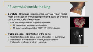 M. tuberculosis outside the lung
◼ Scrofula –Unilateral lymphadenitis (cervical lymph node)
most often seen in immunocompromised adult or children/
caseous necrosis often present
❑ Fine needle aspiration for diagnostic specimen
◼ M. tuberculosis most common in adults
◼ M. avium complex and other MOTT (2-10%) in children
◼ Pott’s disease - TB infection of the spine
❑ Secondary to an extra-spinal source of infection (1* pulmonary)
❑ Manifests as a combination of osteomyelitis and arthritis
that usually involves more than 1 vertebra.
 