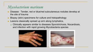 Mycobacterium marinum
◼ Disease: Tender, red or blue/red subcutaneous nodules develop at
the site of trauma
◼ Biopsy (skin) specimens for culture and histopathology
◼ Lesions classically spread up arm along lymphatics,
❑ Clinically appears similar to diseases Sporotrichosis, Nocardiosis,
and infection with rapid growing Mycobacteria species
 