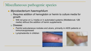 Miscellaneous pathogenic species
◼ Mycobacterium haemophilum
❑ Requires addition of hemoglobin or hemin to culture media for
growth
◼ Will not grow on LJ media or in automated systems (Middlebrook 12B
media) without the addition of hemin supplements
❑ Disease:
◼ Painful subcutaneous nodules and ulcers, primarily in AIDS patients or
immunosuppressed
◼ Lymphadenitis in children
 