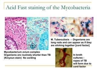 Acid Fast staining of the Mycobacteria
Mycobacterium avium complex
Organisms are routinely shorter than TB
(Kinyoun stain) No cording
M. Tuberculosis - Organisms are
long rods and can appear as if they
are sticking together [cord factor]
In broth
cultures -
ropes of TB
will form due to
cord factor
 