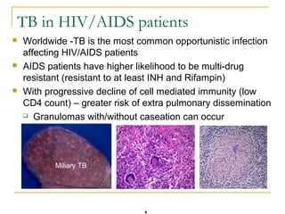TB in HIV/AIDS patients
 Worldwide -TB is the most common opportunistic infection
affecting HIV/AIDS patients
 AIDS pati...
