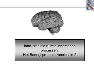 Intra-craniale ruimte innemende
           processen.
Het Banerji protocol: voorbeeld 2
 