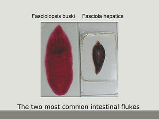 Fasciolopsis buski Fasciola hepatica
The two most common intestinal flukes
 