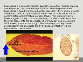 Fasciola hepatica
Distinct nose
Fascioliasis is a parasitic infection typically caused by Fasciola hepatica,
also known as "the common liver fluke" or "the sheep liver fluke.
Fascioliasis is found in all 5 continents, especially where sheep or cattle
are reared. Infected by eating raw watercress or other water plants
contaminated with immature parasite larvae. The immature larval
flukes migrate through the intestinal wall, the abdominal cavity, and
the liver tissue, into the bile ducts, where they develop into mature
adult flukes, which produce eggs. The pathology typically is most
pronounced in the bile ducts and liver. Fasciola infection is both
treatable and preventable
 