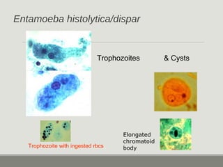 Entamoeba histolytica/dispar
Trophozoites & Cysts
Trophozoite with ingested rbcs
Elongated
chromatoid
body
 