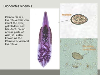 Clonorchis sinensis
knobbin
Shoulders
operculates
Clonorchis is a
liver fluke that can
infect the liver,
gallbladder and
bile duct. Found
across parts of
Asia, it is also
known as the
Chinese or oriental
liver fluke.
 