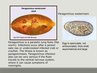 Egg is operculate, not
embryonated, thick shell,
asymmetrical and large
Paragonimus westermani
Paragonimus is a parasitic lung fluke (flat
worm). Infections occur after a person
eats raw or undercooked infected crab or
crayfish. The illness is known as
paragonimiasis. Paragonimus infection
also can be very serious if the fluke
travels to the central nervous system,
where it can cause symptoms of
meningitis.
 
