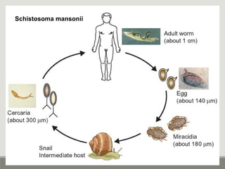Schistosoma mansonii
 