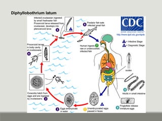 Diphyllobothrium latum
 