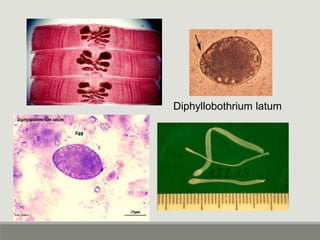 Diphyllobothrium latum
 